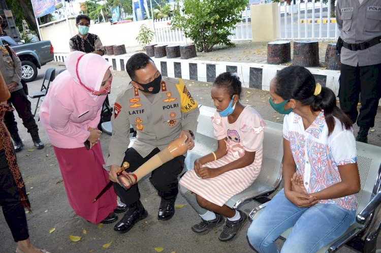 Ibunya Menangis Terharu Saat Kapolda NTT Memberikan Bantuan Kaki Palsu Kepada Anaknya yang Cacat sejak Lahir