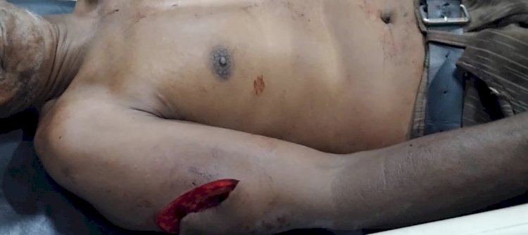 Cekcok Saat Pesta Berujung Pembacokan, Polsek Alok Tangani Kasus Penganiayaan Berat di Wuring Laut